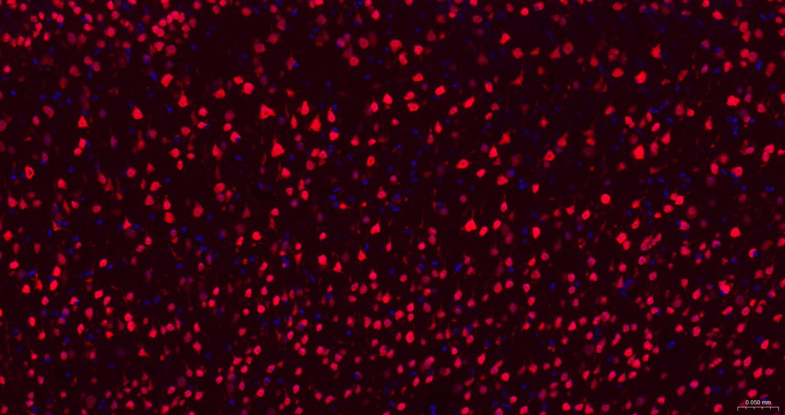神经元核抗原重组兔单抗