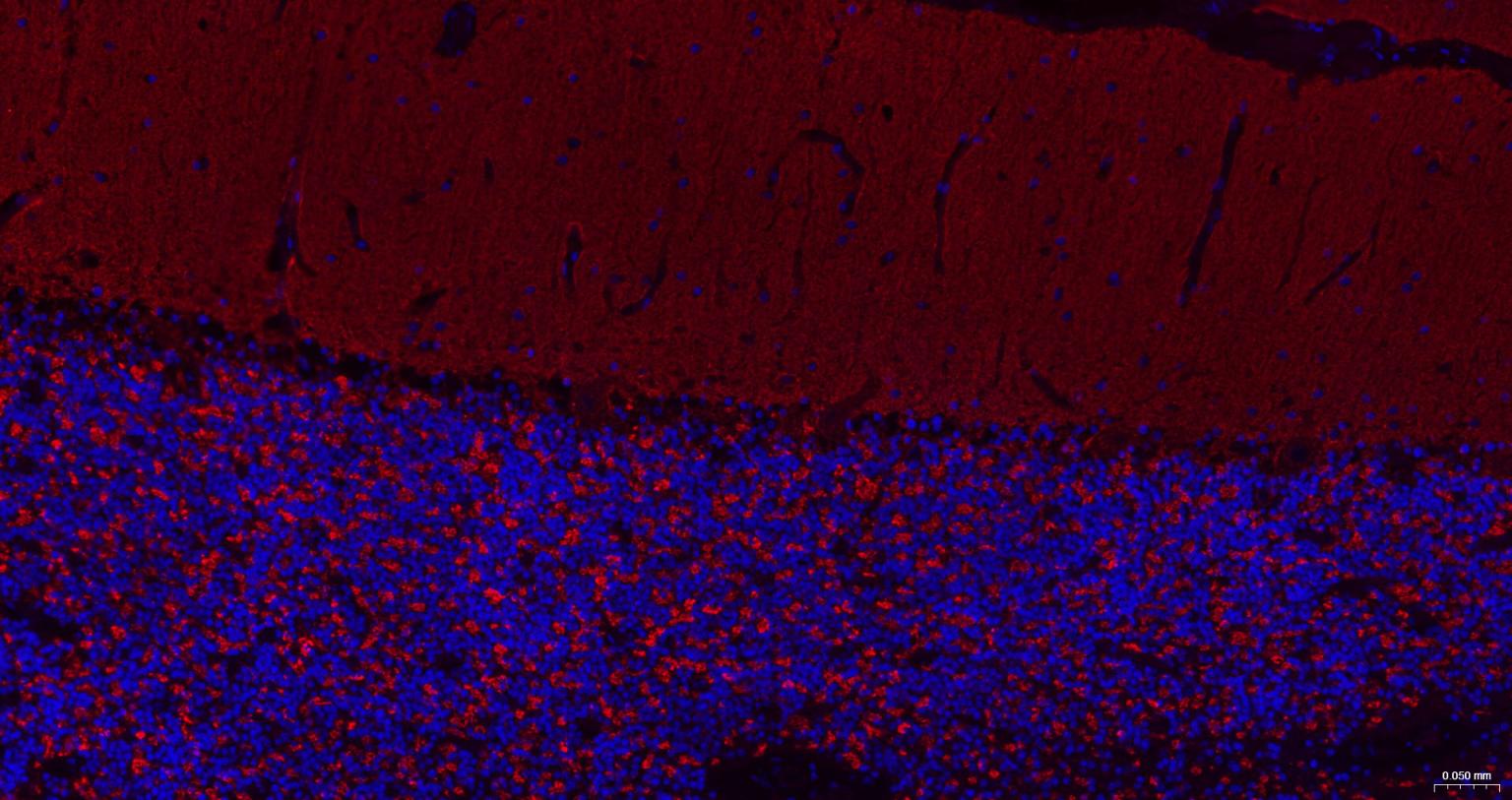 突触小泡蛋白P38重组兔单抗