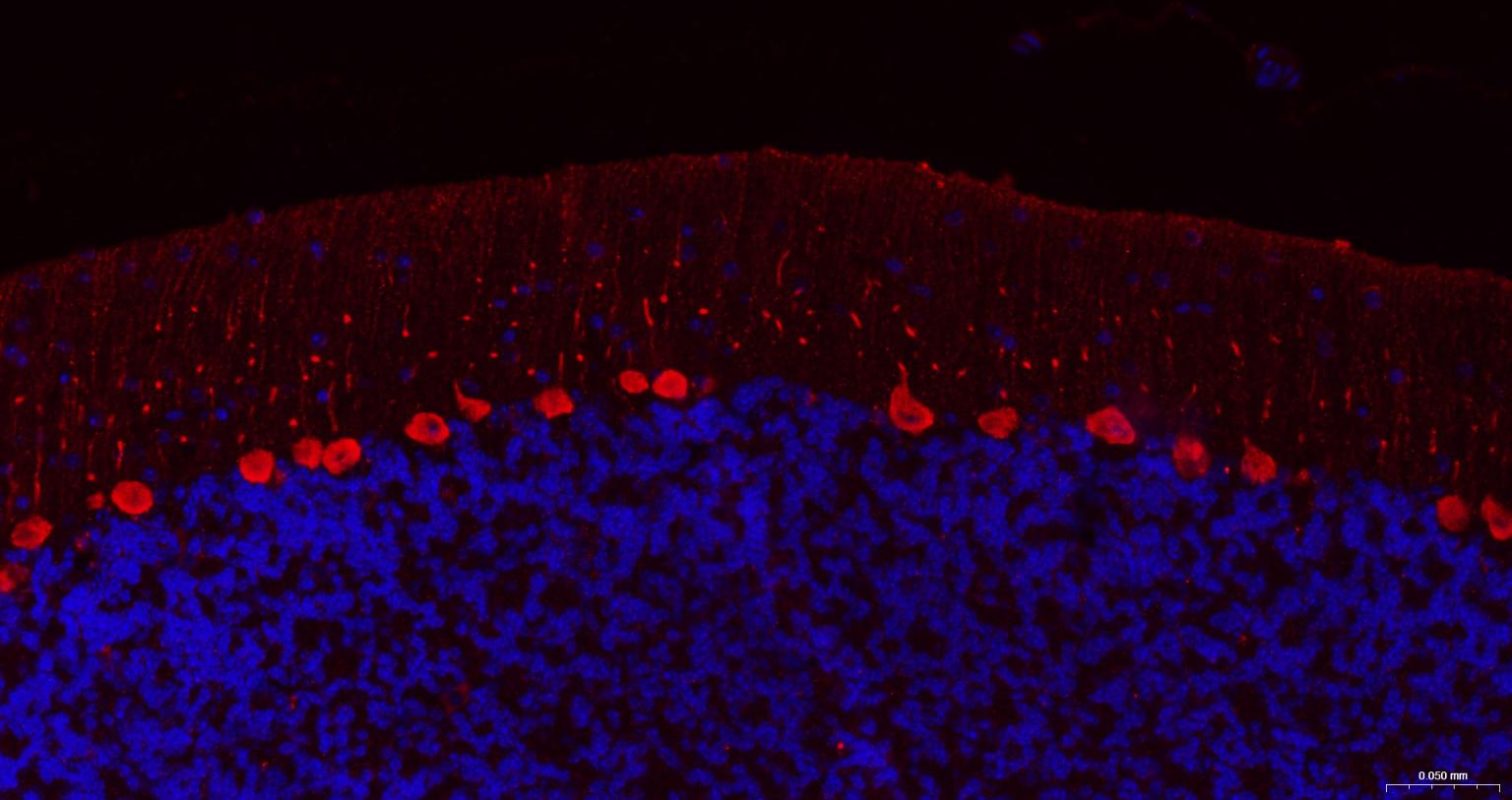 钙结合蛋白D28K抗体-bs-10177R