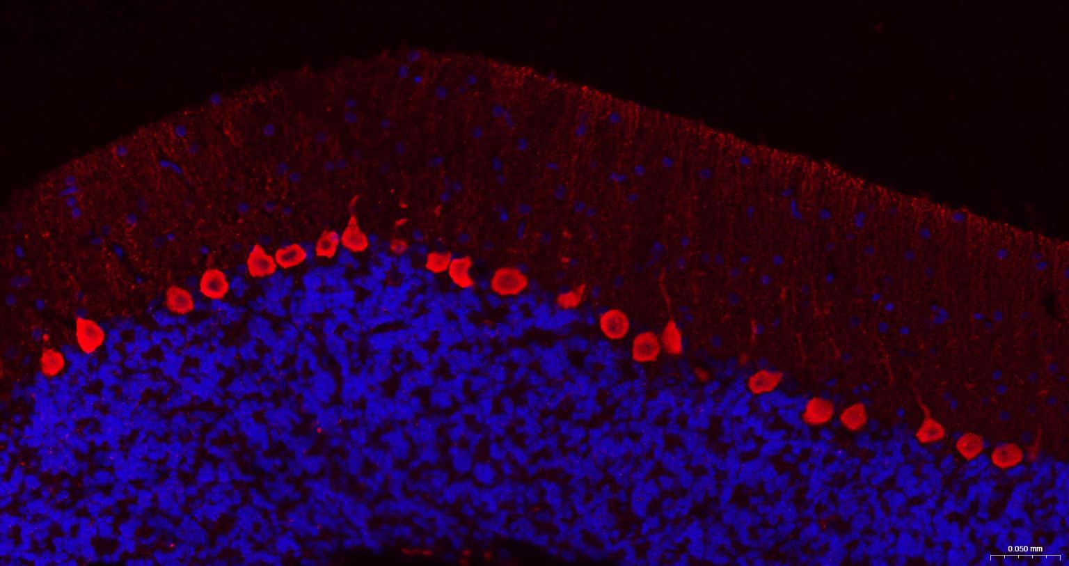 钙结合蛋白D28K抗体-bs-10177R