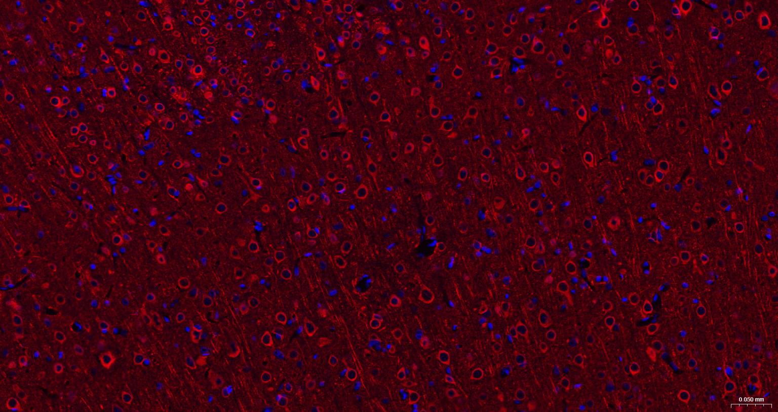 微管蛋白β3重组兔单抗