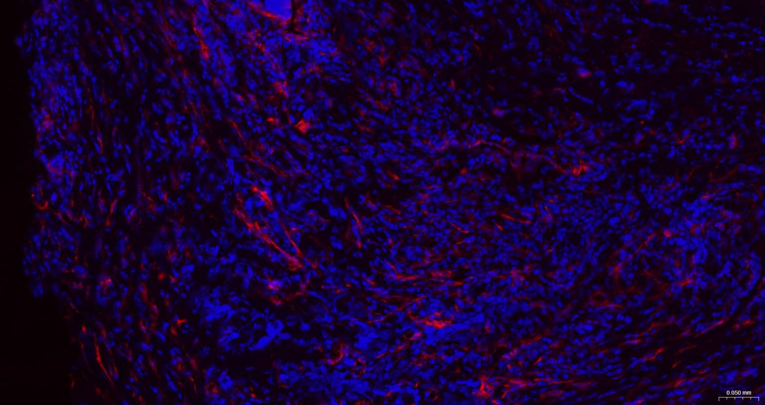 微管蛋白β3重组兔单抗