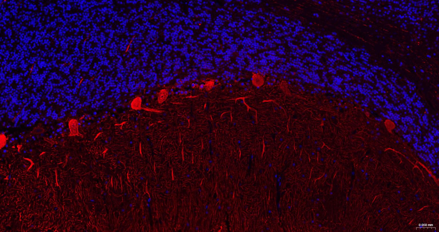 钙结合蛋白D28K重组兔单抗