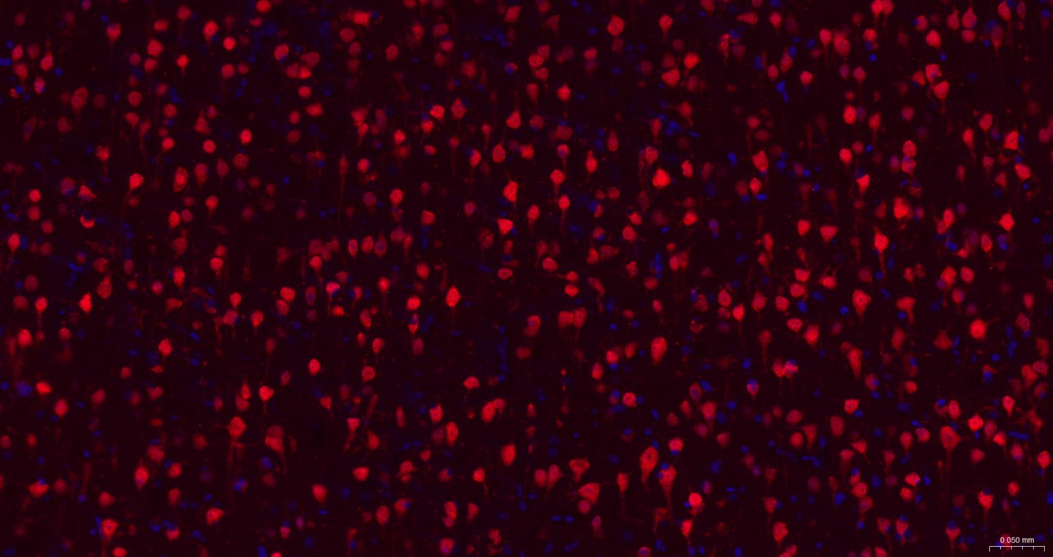 神经元核抗原重组兔单抗