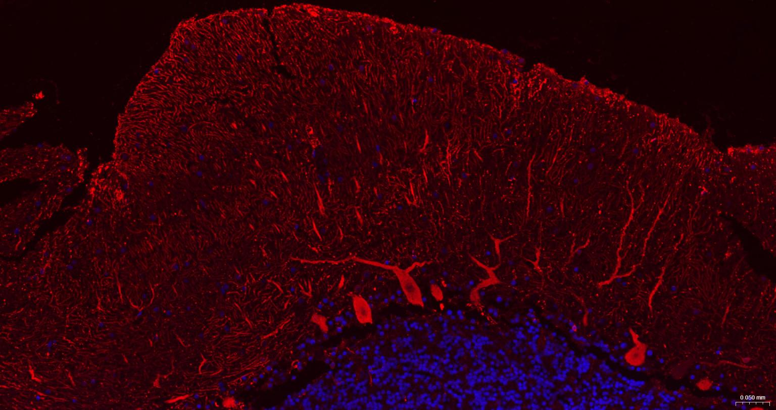 钙结合蛋白D28K抗体-bs-10177R