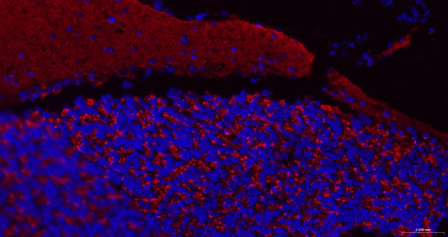 突触小泡蛋白P38重组兔单抗