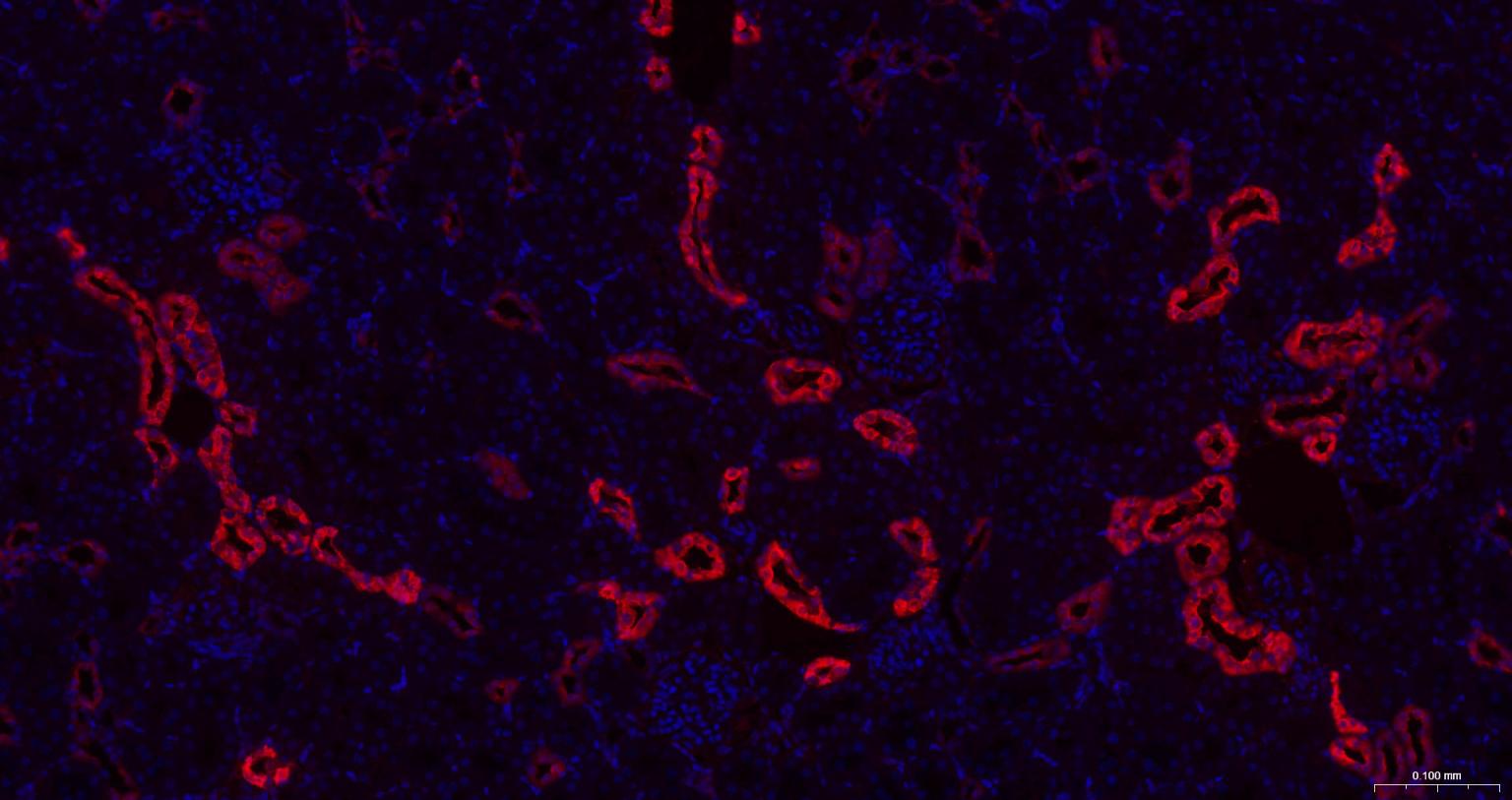 钙结合蛋白D28K重组兔单抗