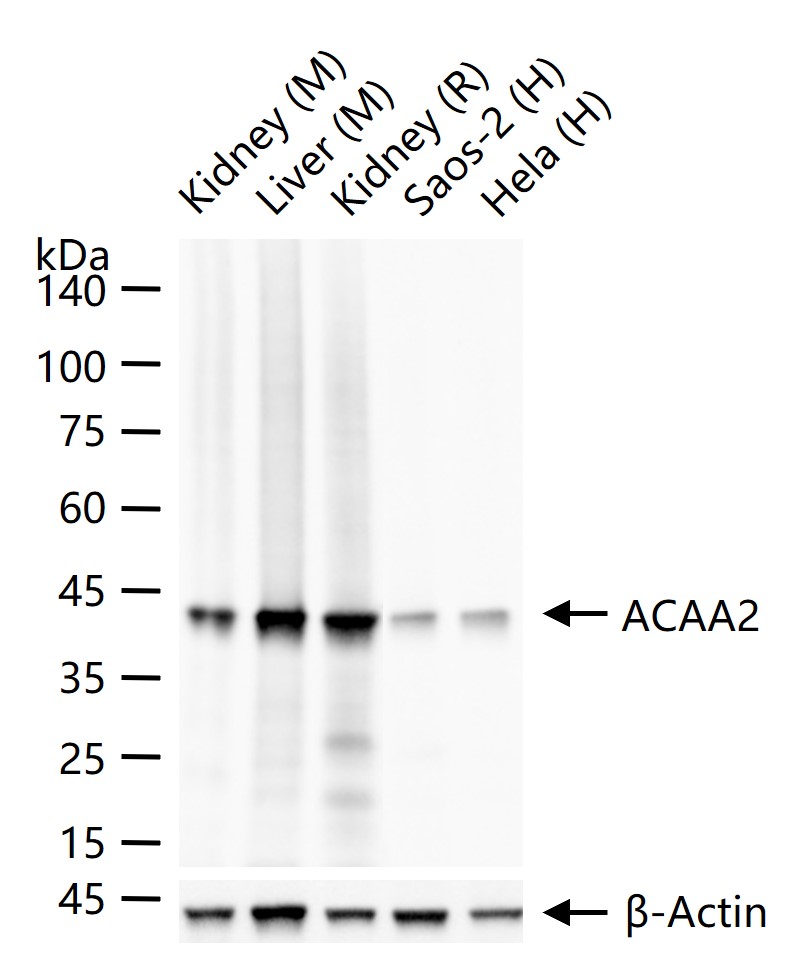 ACAA2重组兔单抗