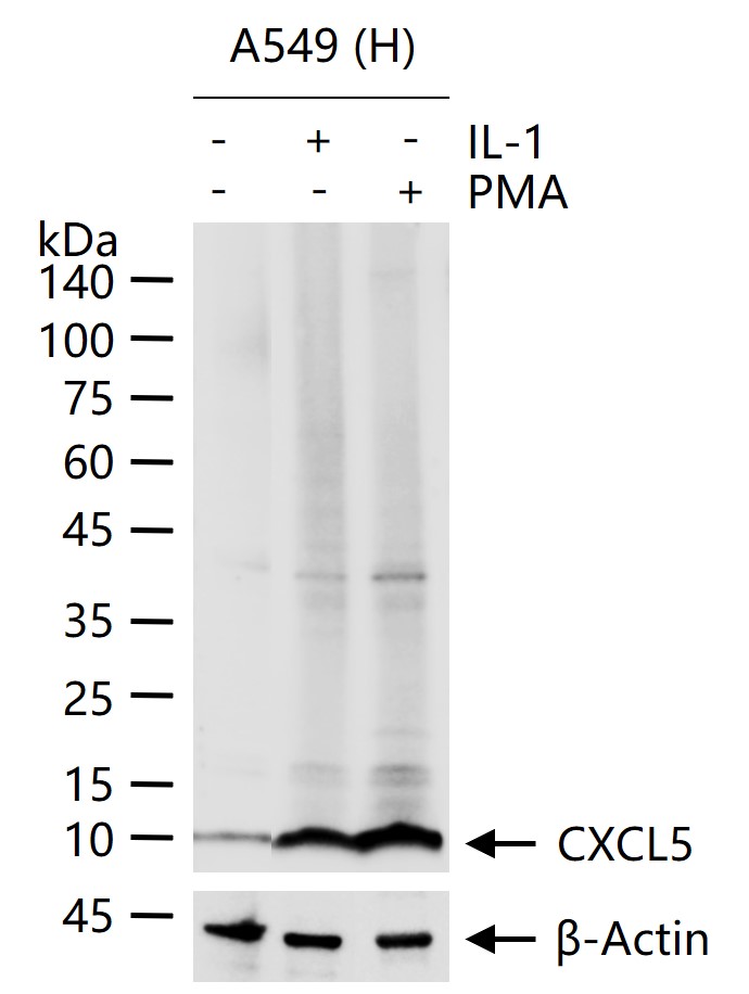 上皮中性粒细胞活化肽78重组兔单抗