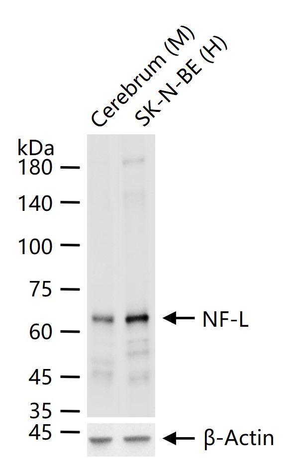 NEFL | NF-L Rabbit pAb (一抗) - WB | Bioss