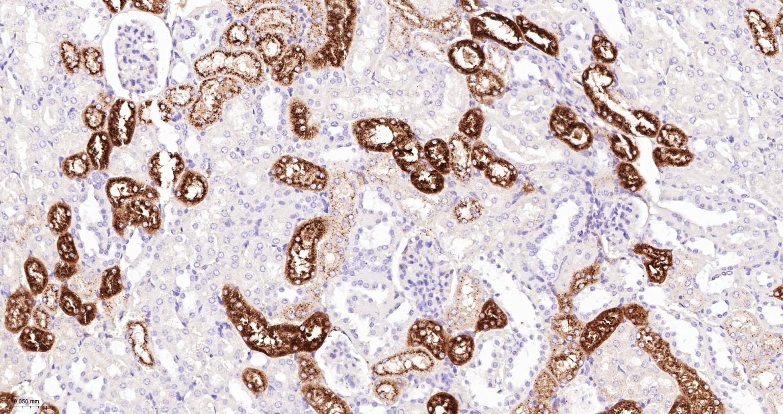 溶菌酶重组兔单抗