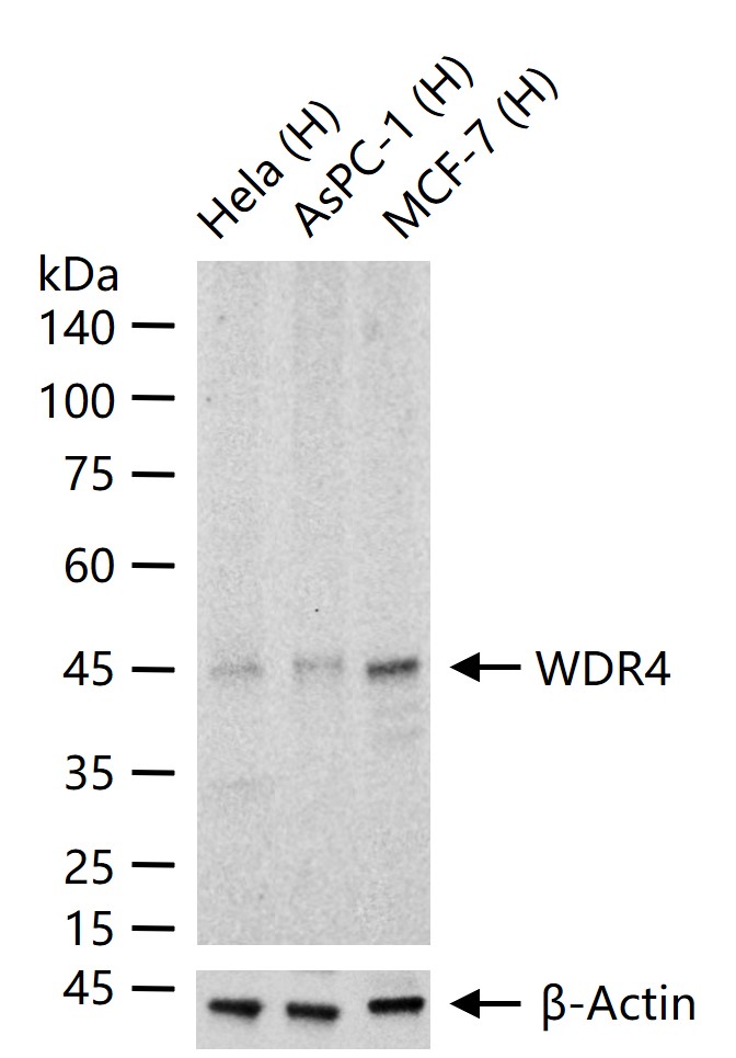 WDR4重组兔单抗