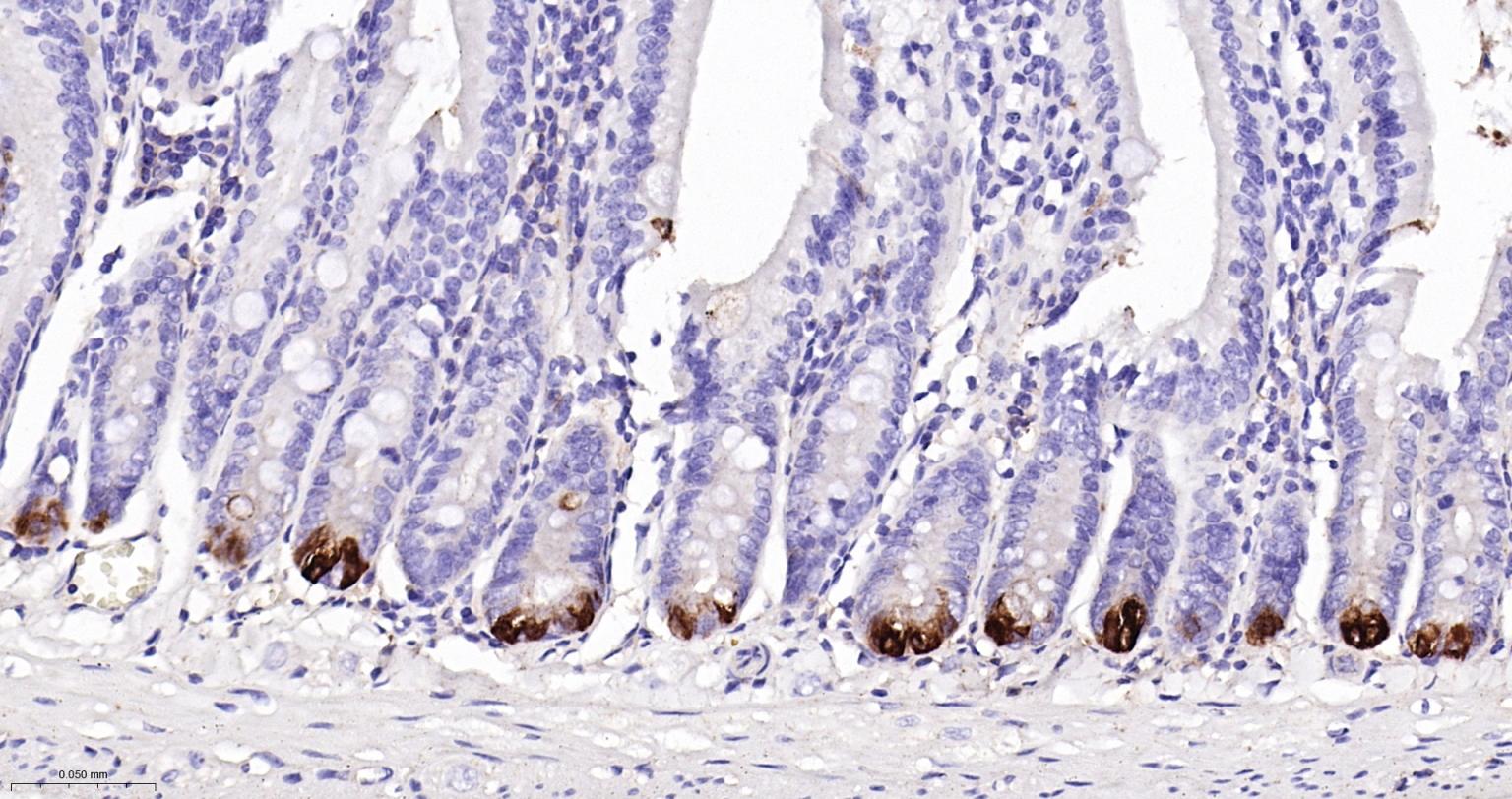 溶菌酶重组兔单抗