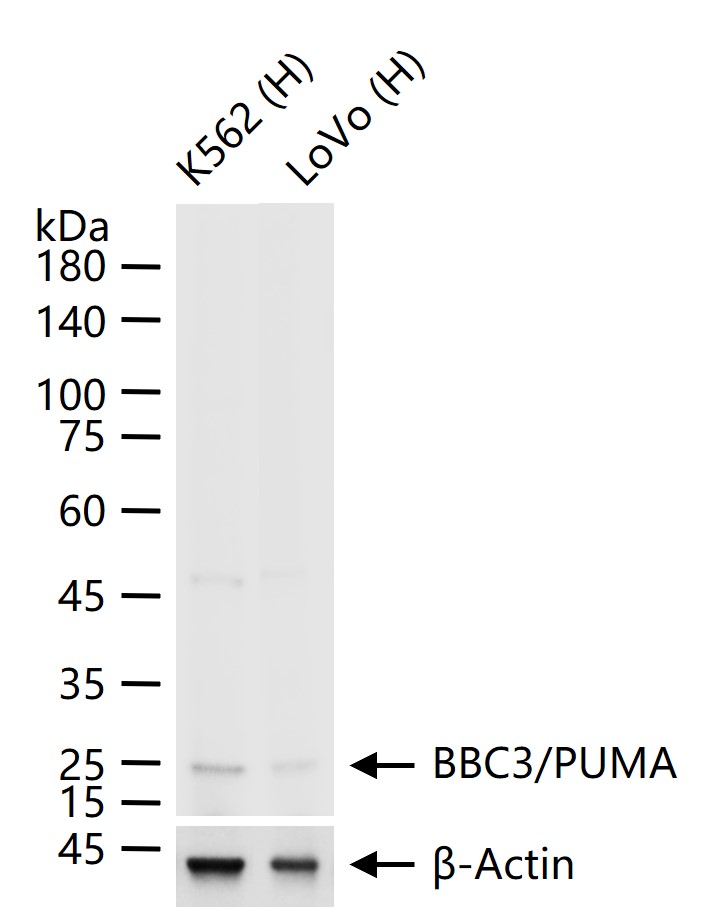p53正向细胞凋亡调控因子重组兔单抗