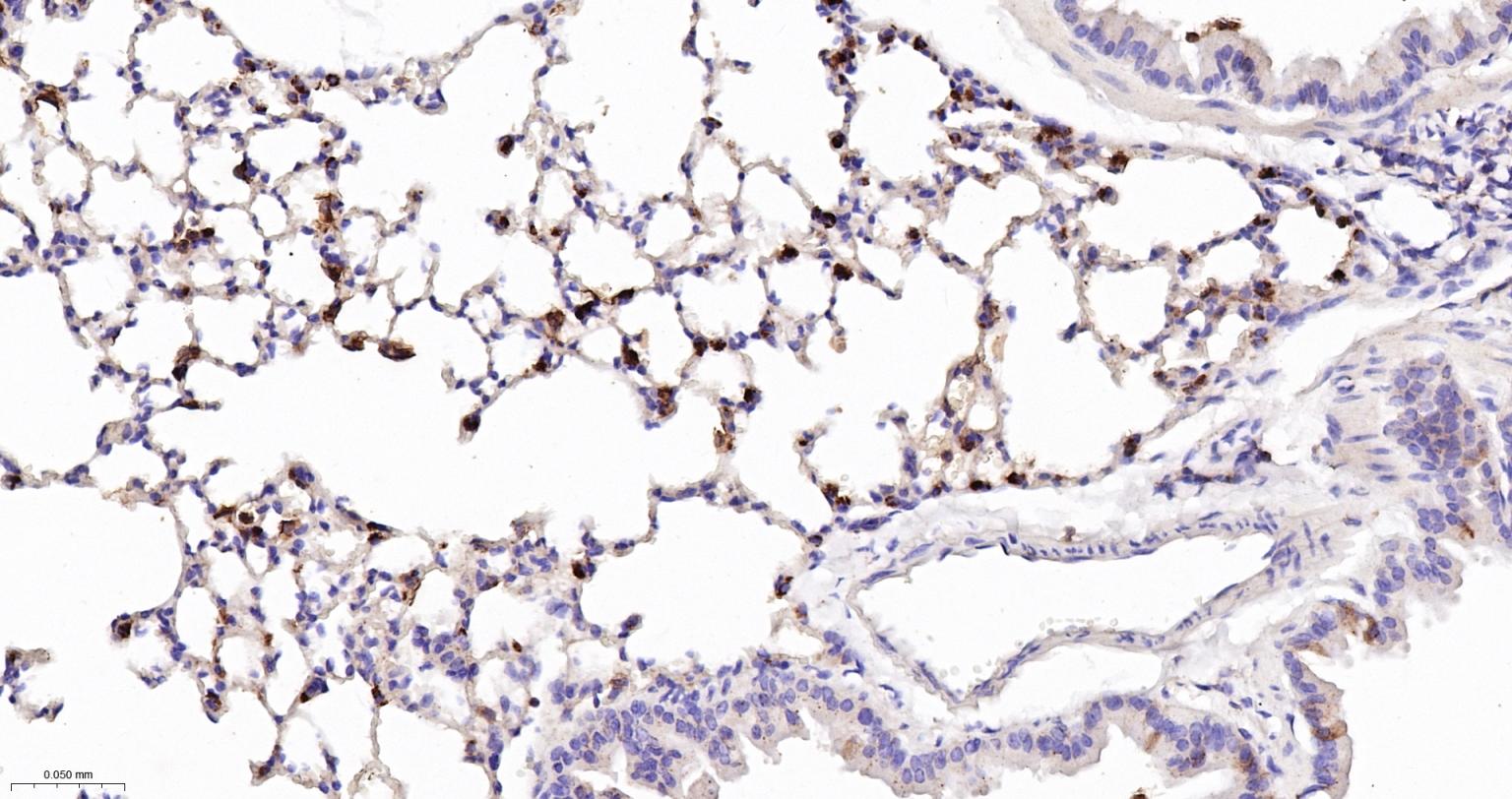 溶菌酶重组兔单抗