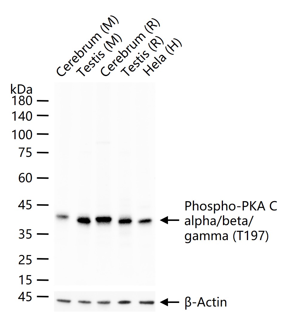 磷酸化蛋白激酶A α/β/γ重组兔单抗