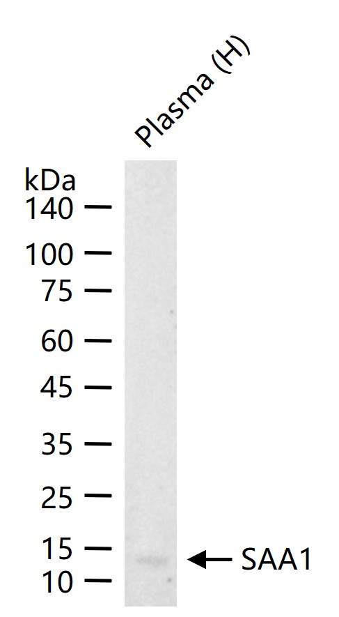 SAA1 Recombinant Rabbit mAb (一抗) - WB,IHC-P,IHC-F,IF | Bioss