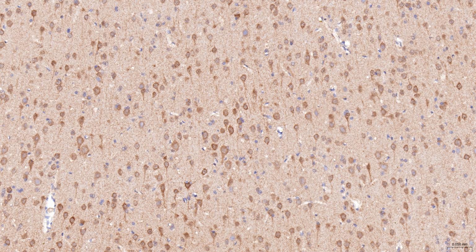 热休克蛋白105重组兔单抗