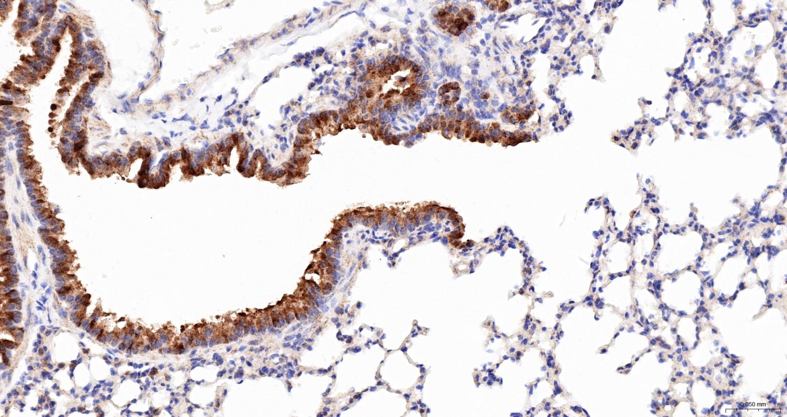 热休克蛋白105重组兔单抗
