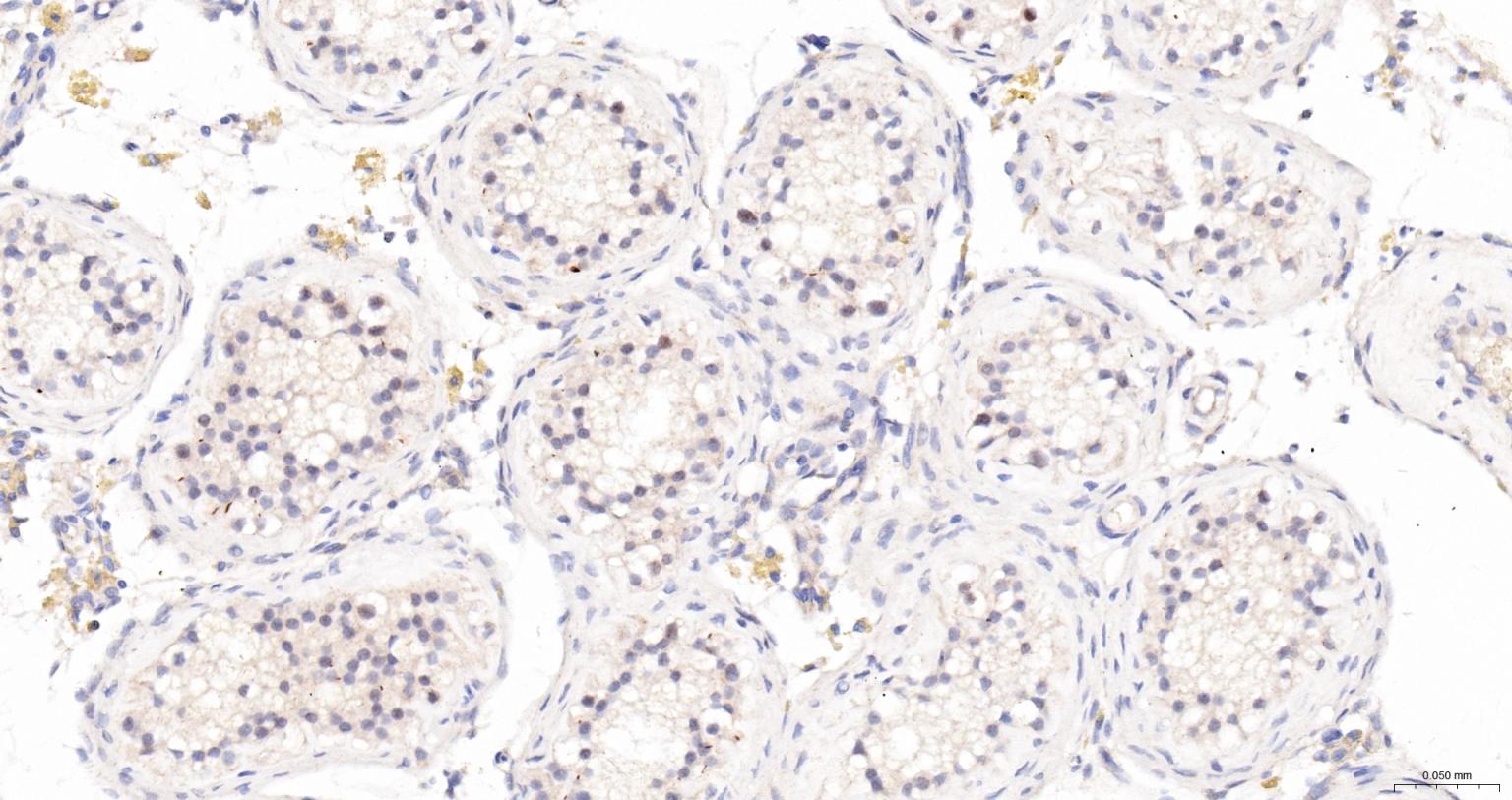 核孔复合蛋白Nup98重组兔单抗