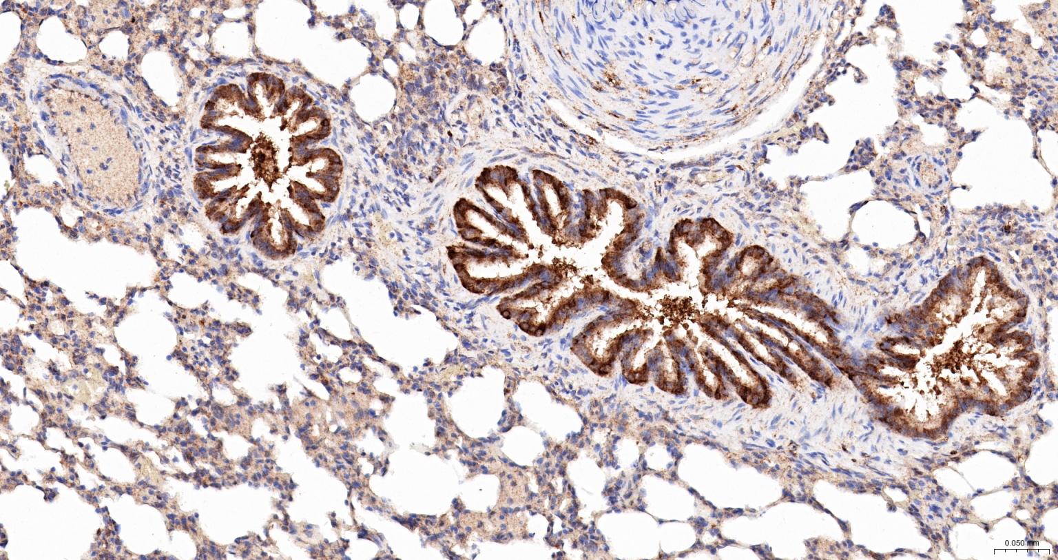 热休克蛋白105重组兔单抗