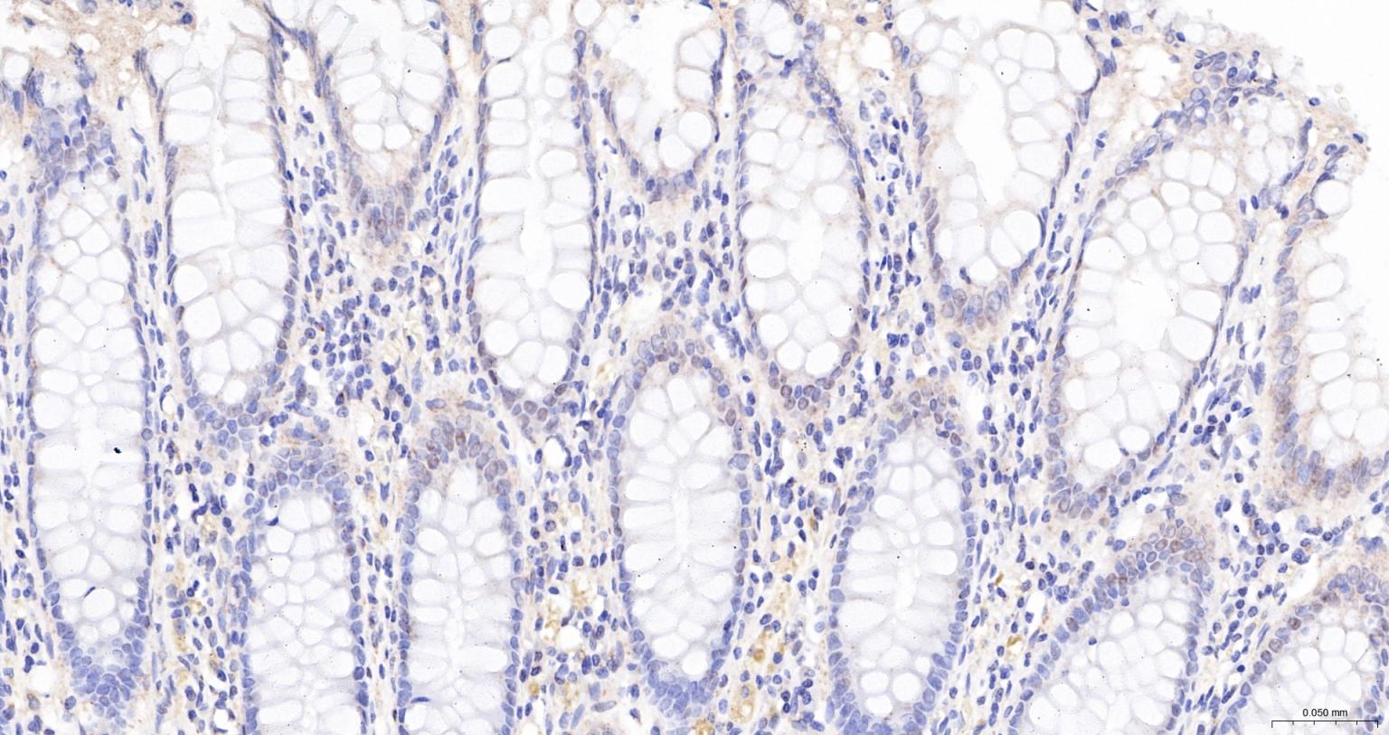 核孔复合蛋白Nup98重组兔单抗