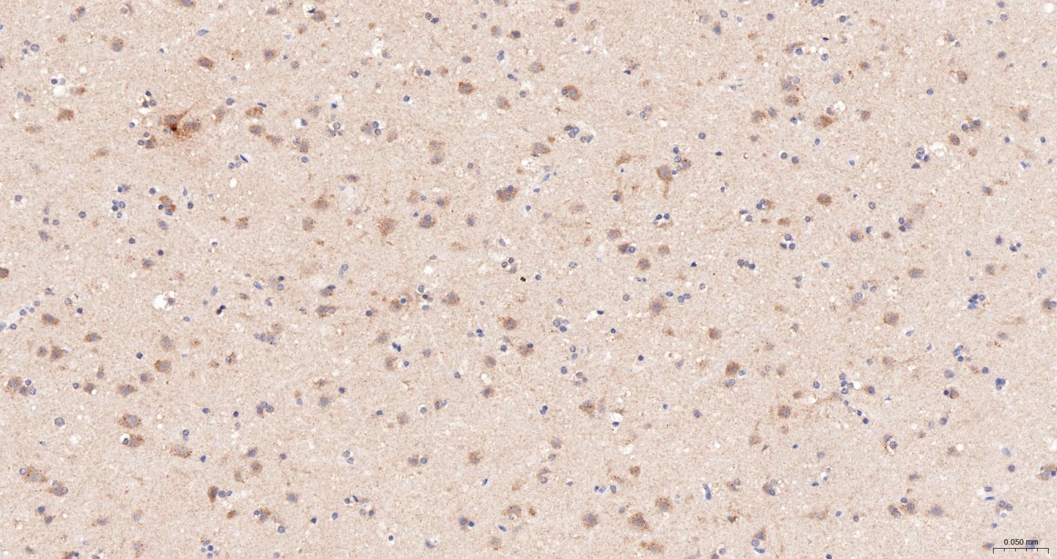 热休克蛋白105重组兔单抗