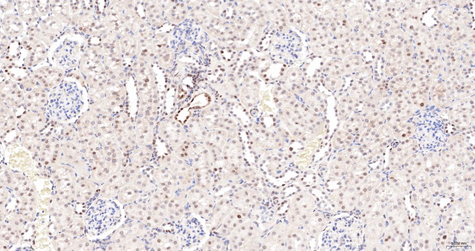 核孔复合蛋白Nup98重组兔单抗