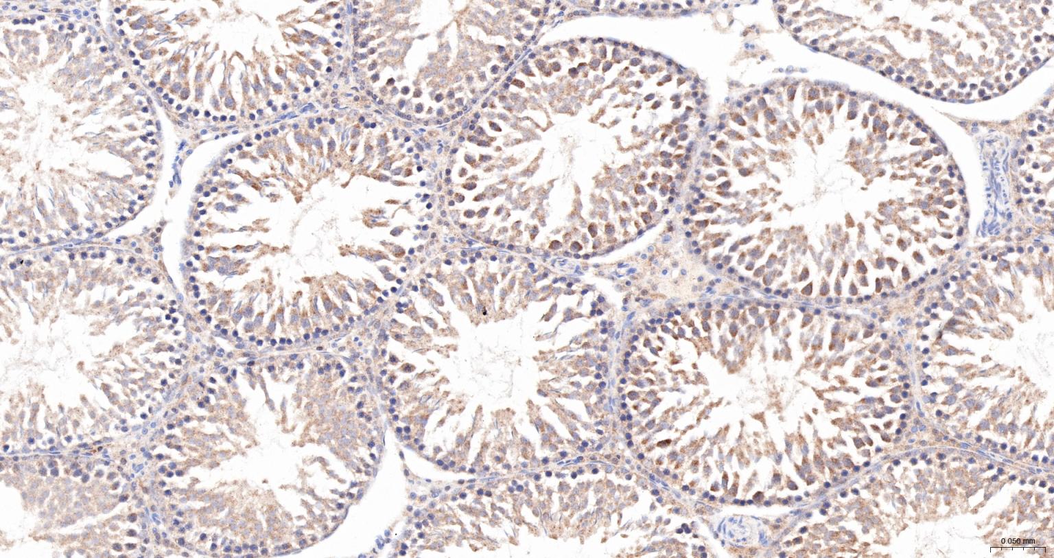 热休克蛋白105重组兔单抗