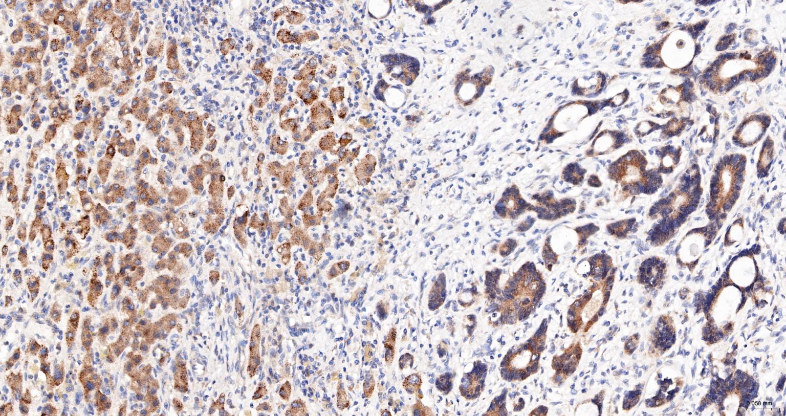 热休克蛋白105重组兔单抗
