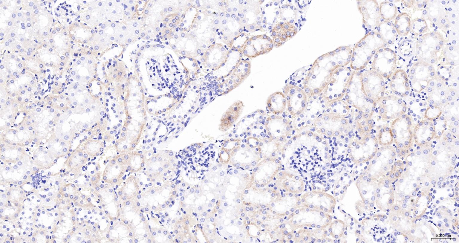 ACAA2重组兔单抗