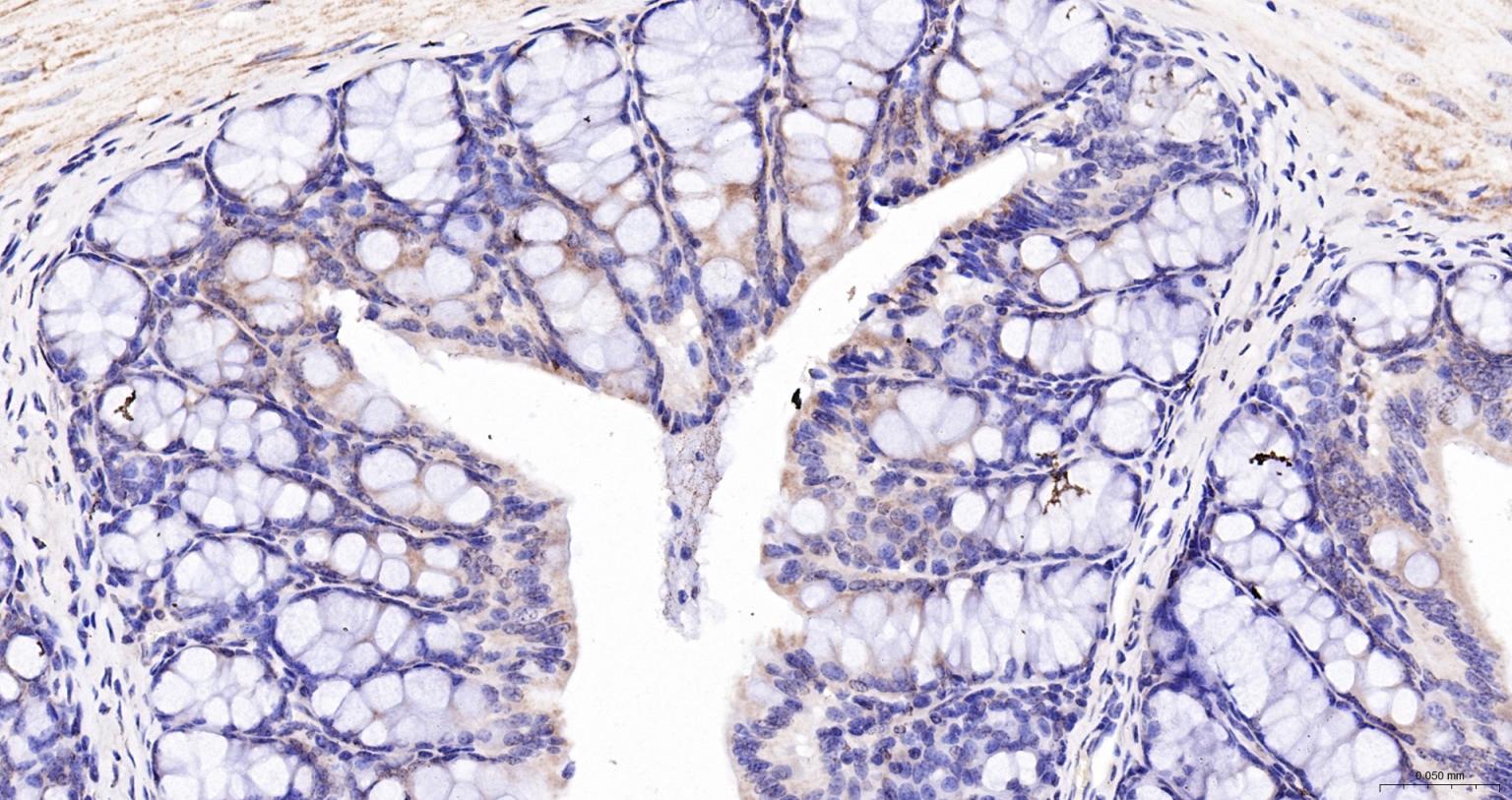 ACAA2重组兔单抗