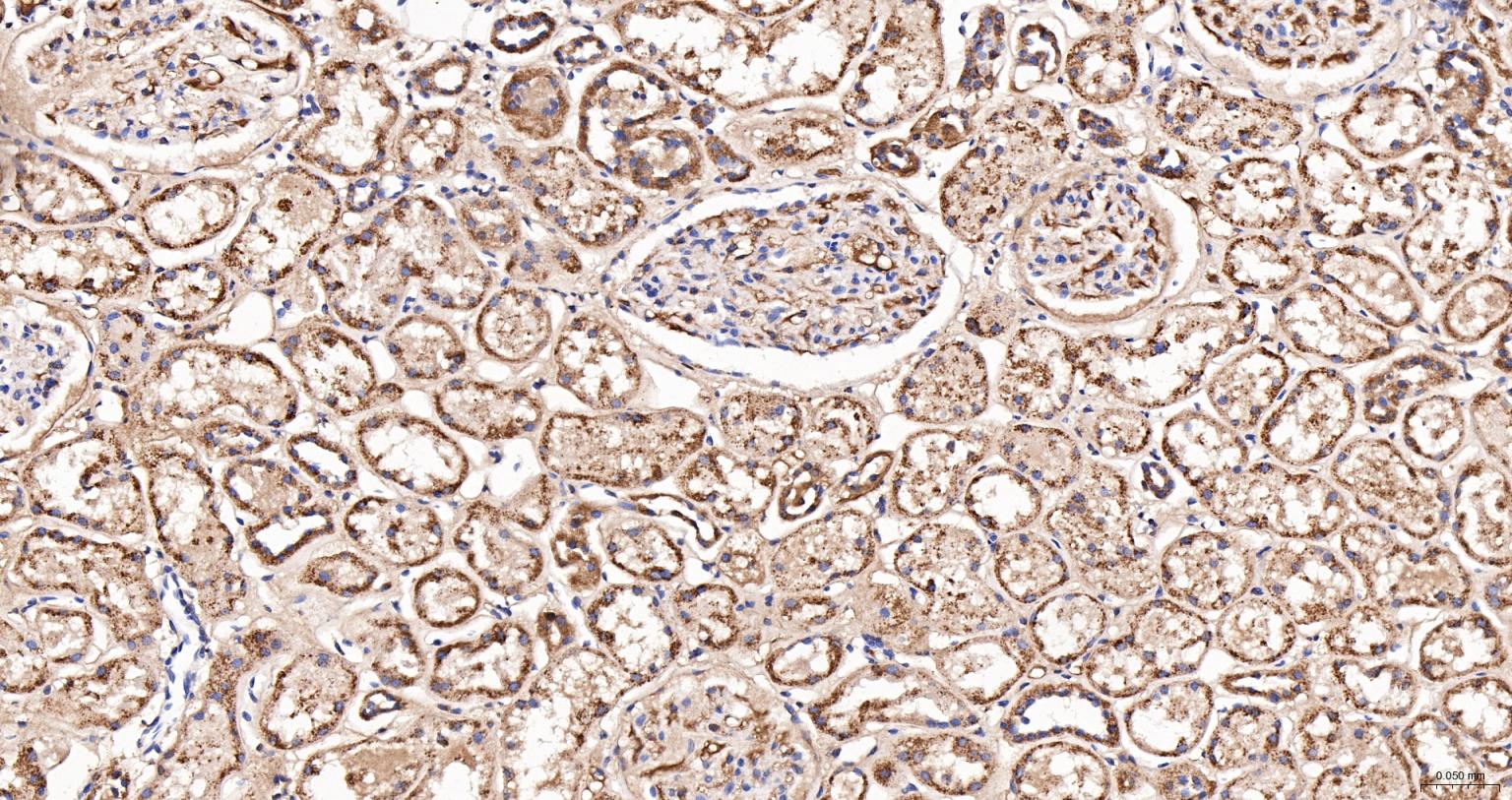 ACAA2重组兔单抗