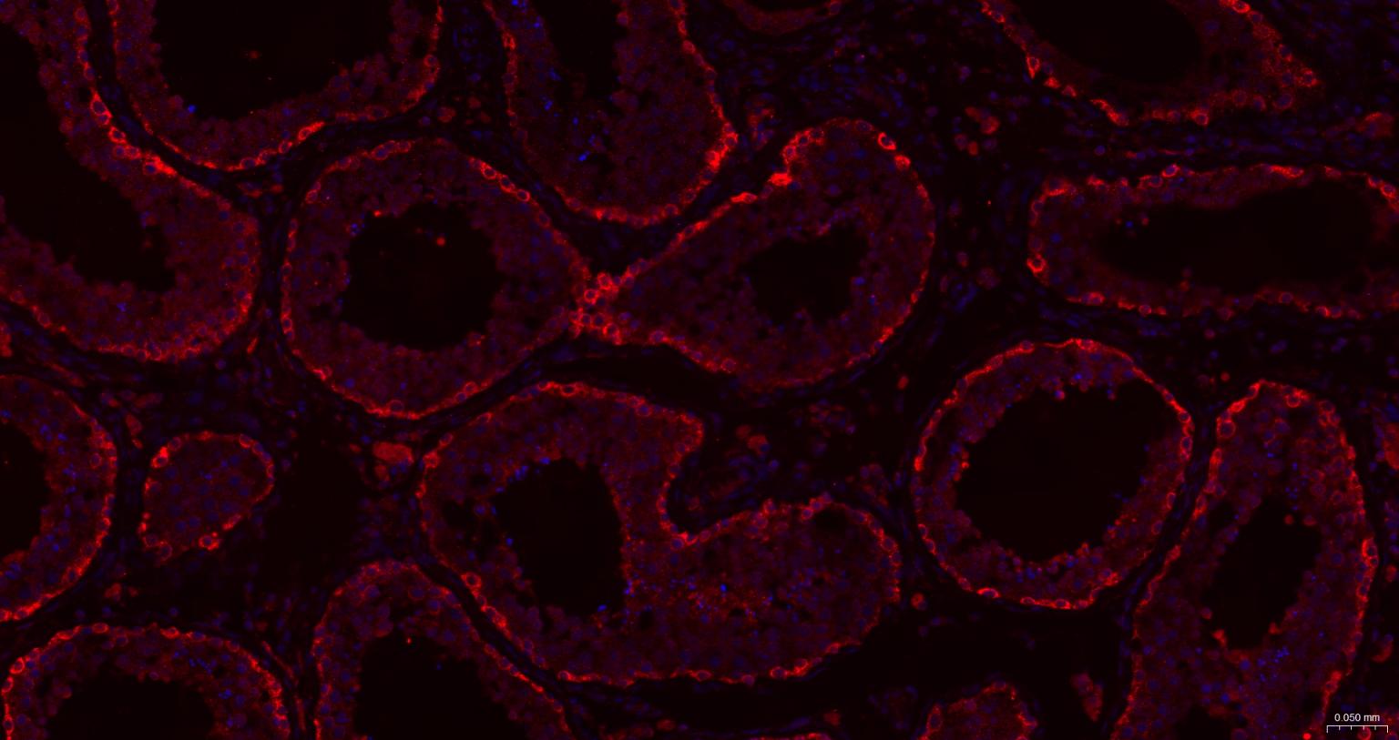 热休克蛋白105重组兔单抗