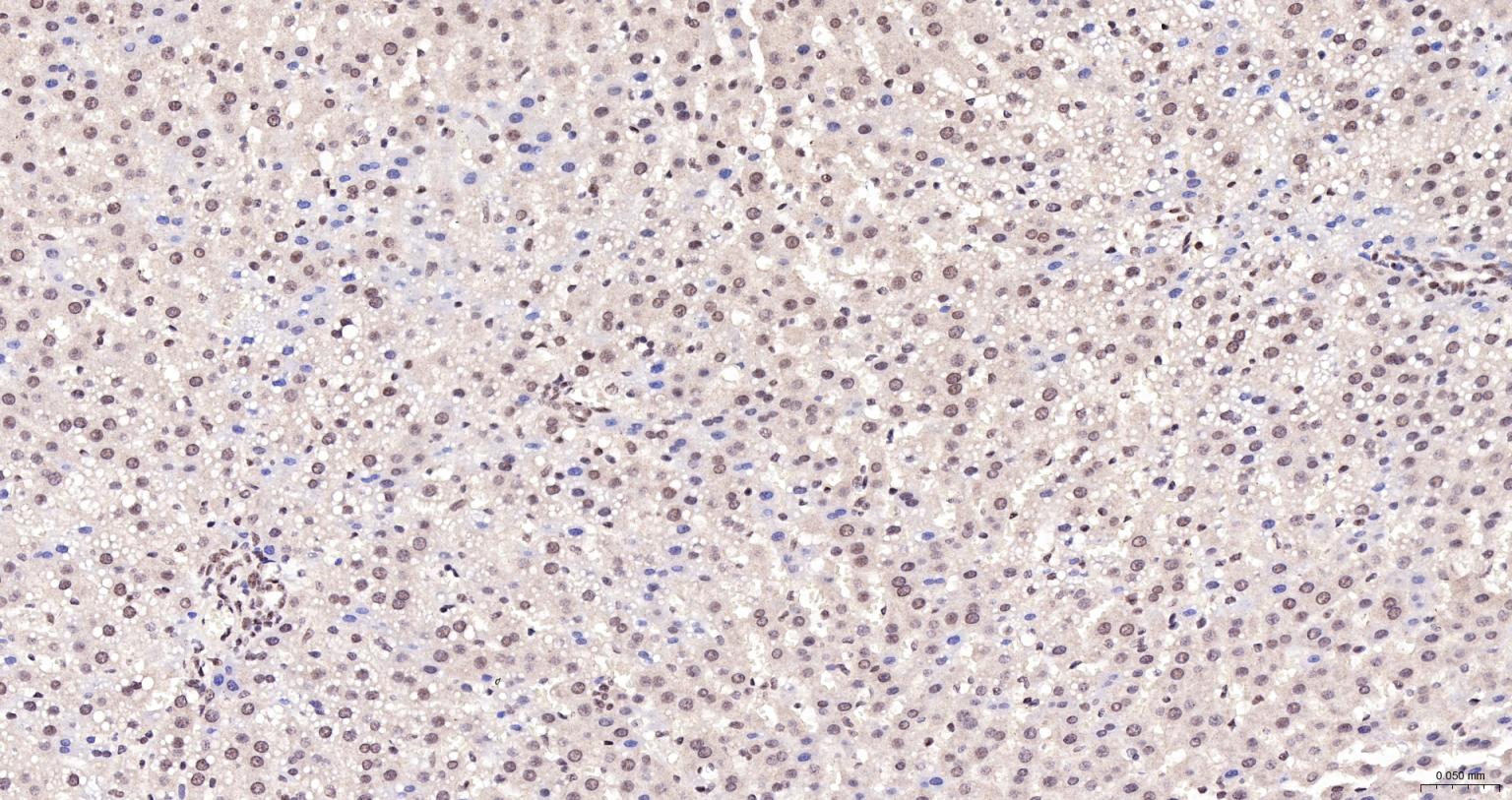 激活STAT蛋白抑制因子1/2重组兔单抗-bsm-62931R