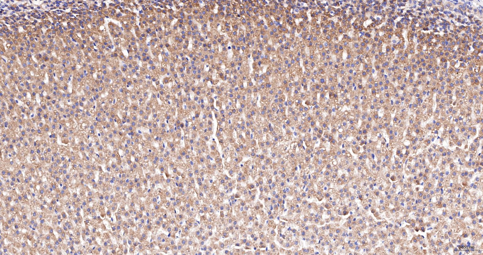 ACAA2重组兔单抗
