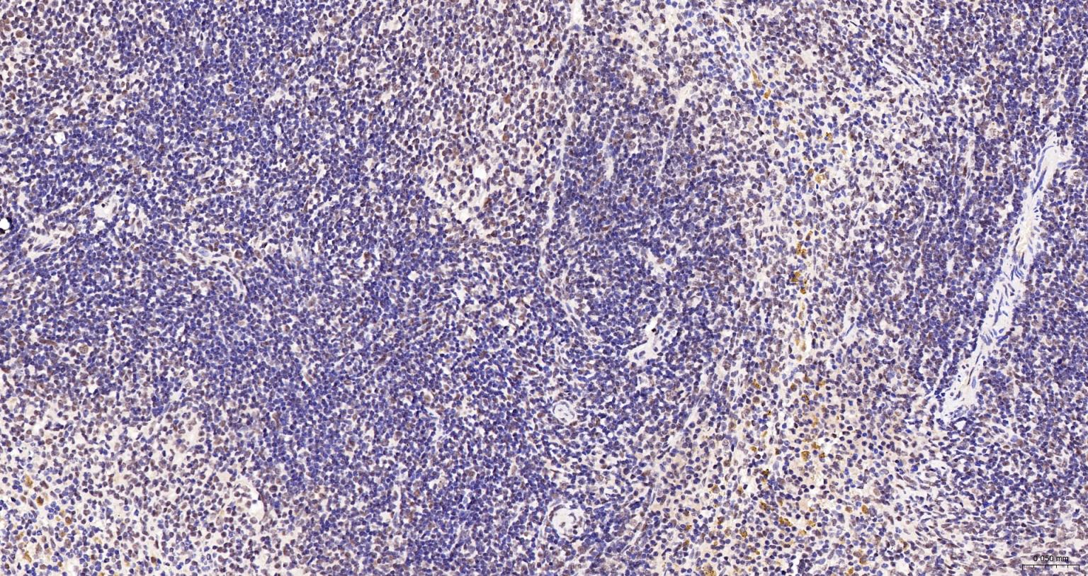 激活STAT蛋白抑制因子1/2重组兔单抗-bsm-62931R