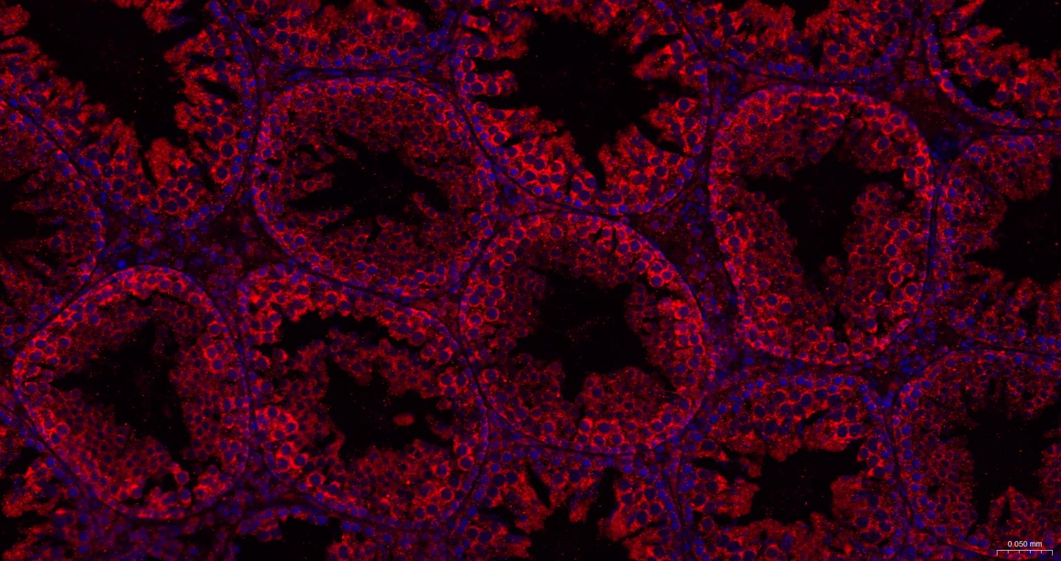 热休克蛋白105重组兔单抗