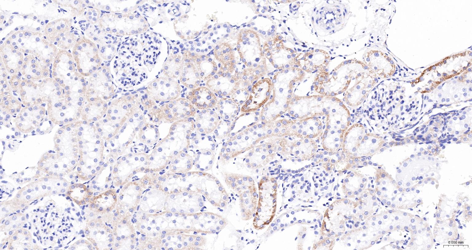 ACAA2重组兔单抗