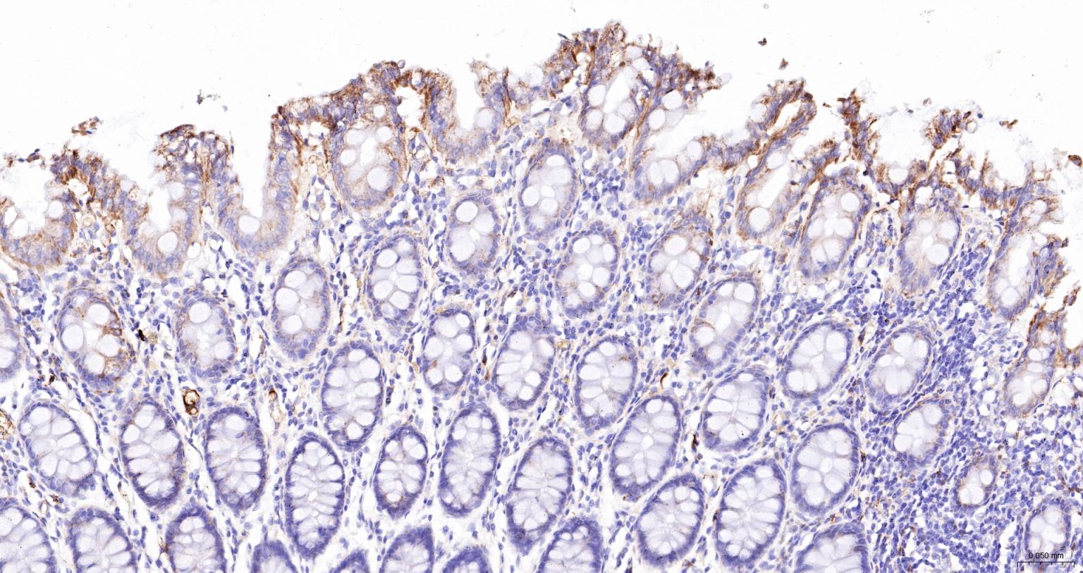 ACAA2重组兔单抗