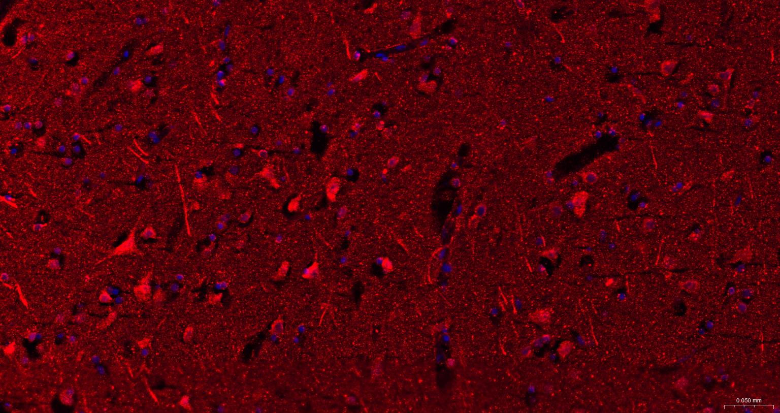 神经迁移蛋白Slit2/3重组兔单抗