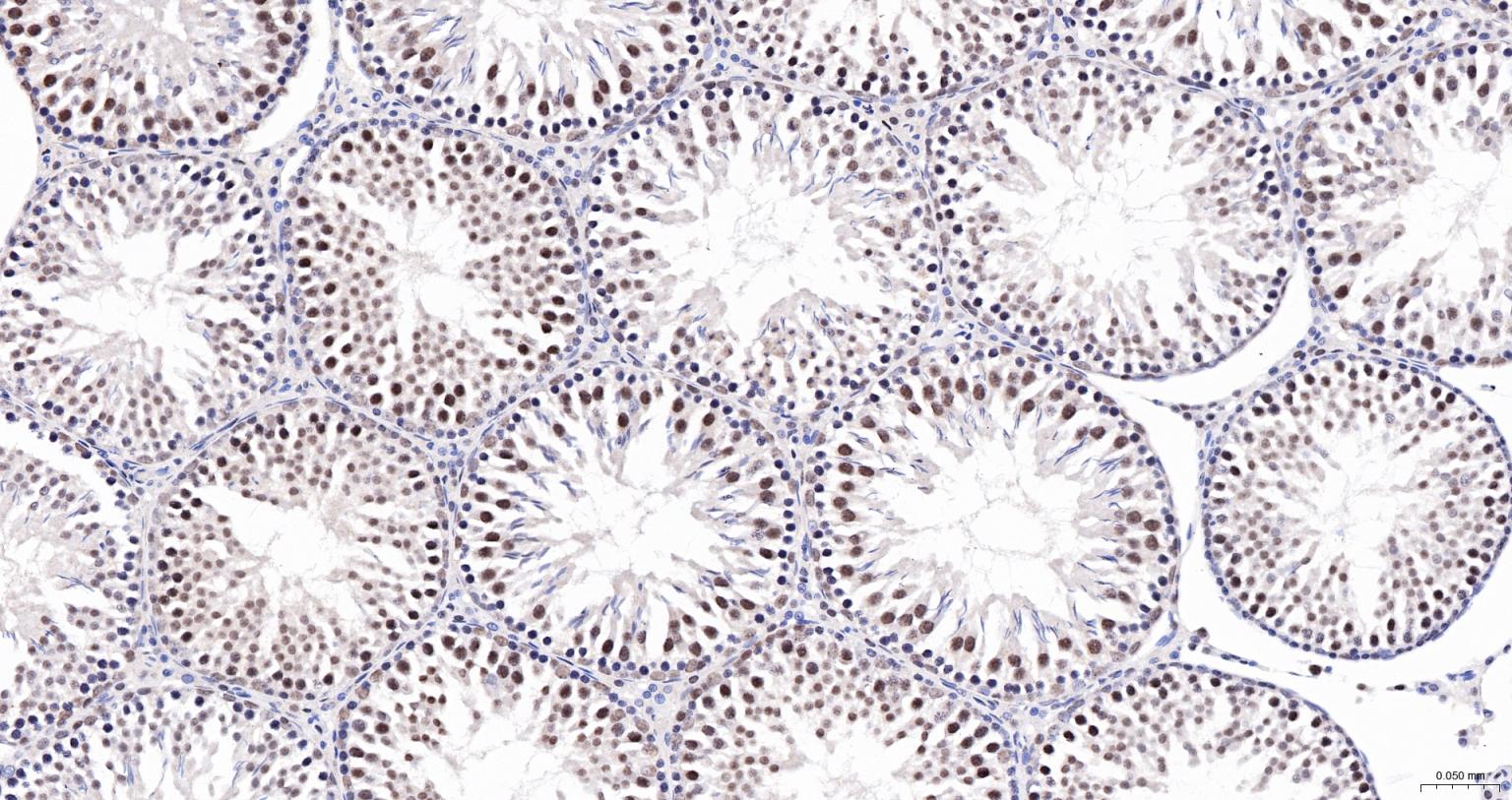 激活STAT蛋白抑制因子1/2重组兔单抗-bsm-62931R
