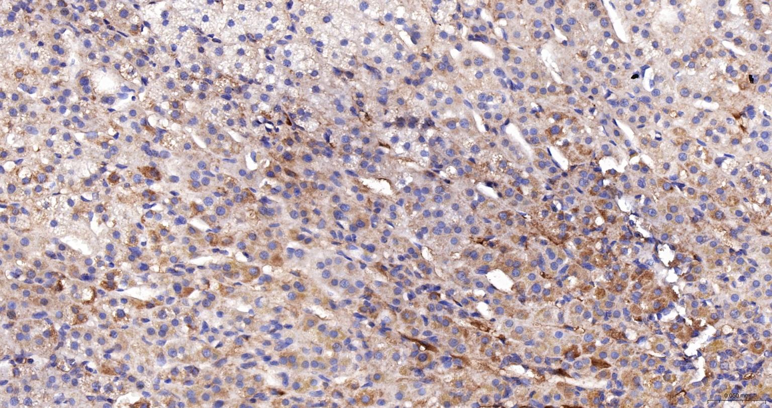 ACAA2重组兔单抗