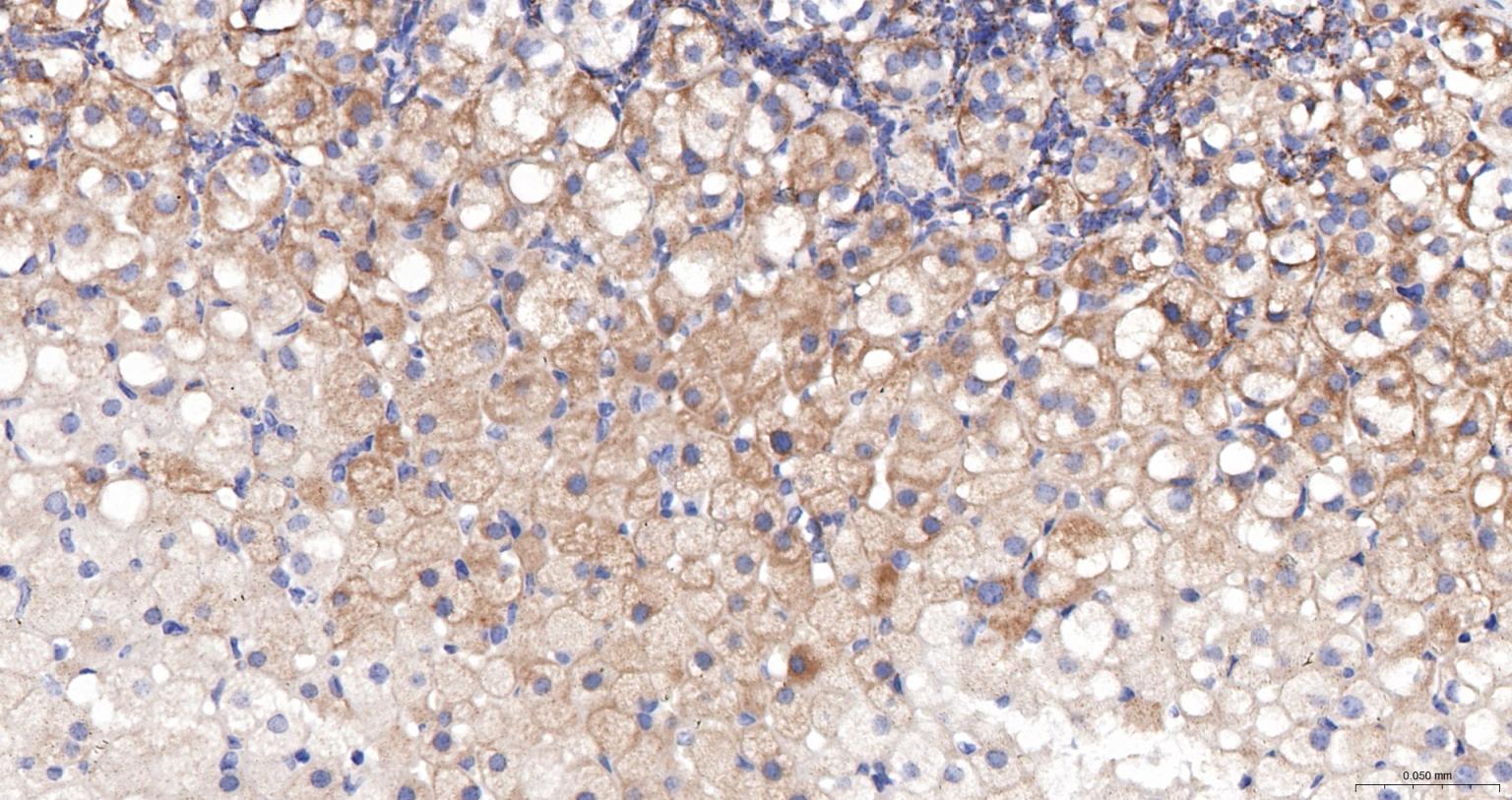 ACAA2重组兔单抗