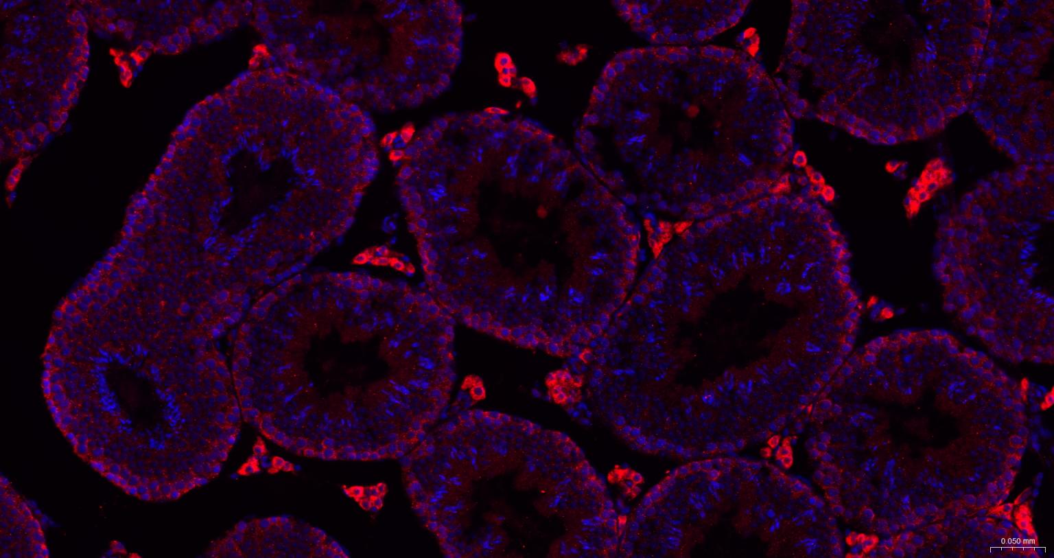 热休克蛋白105重组兔单抗