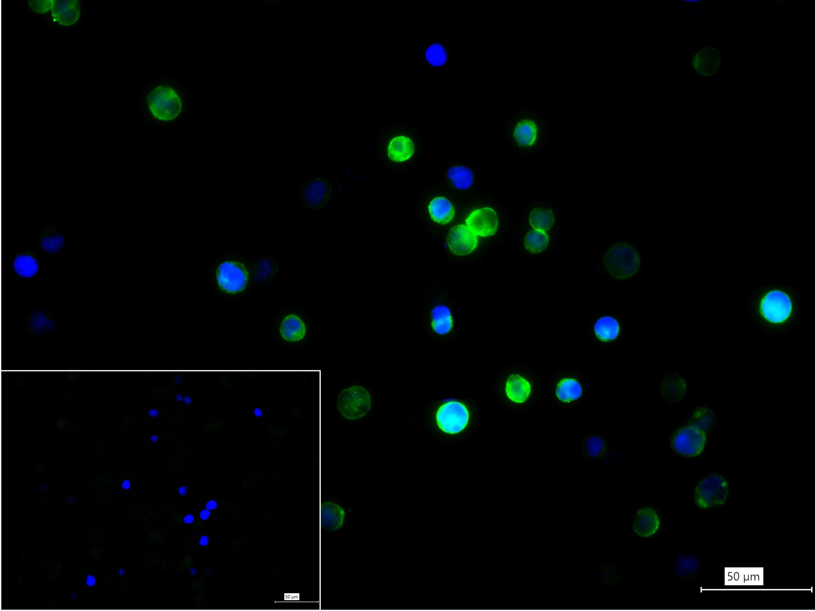 巨噬细胞甘露糖受体 (CD206)重组兔单抗