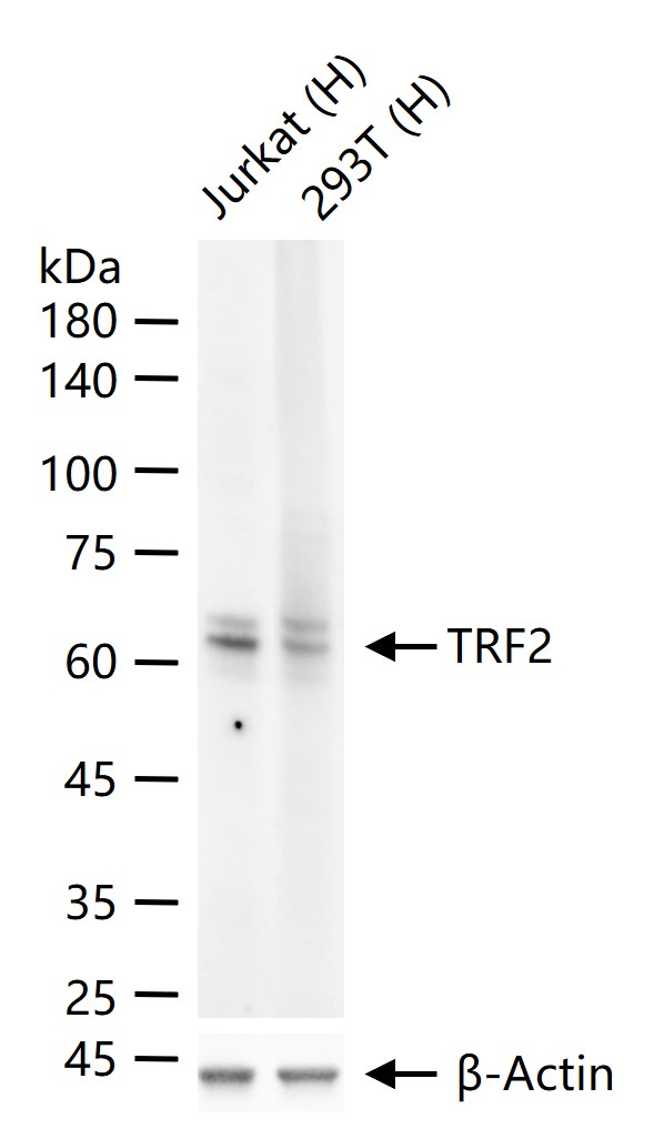 端粒结合蛋白2重组兔单抗