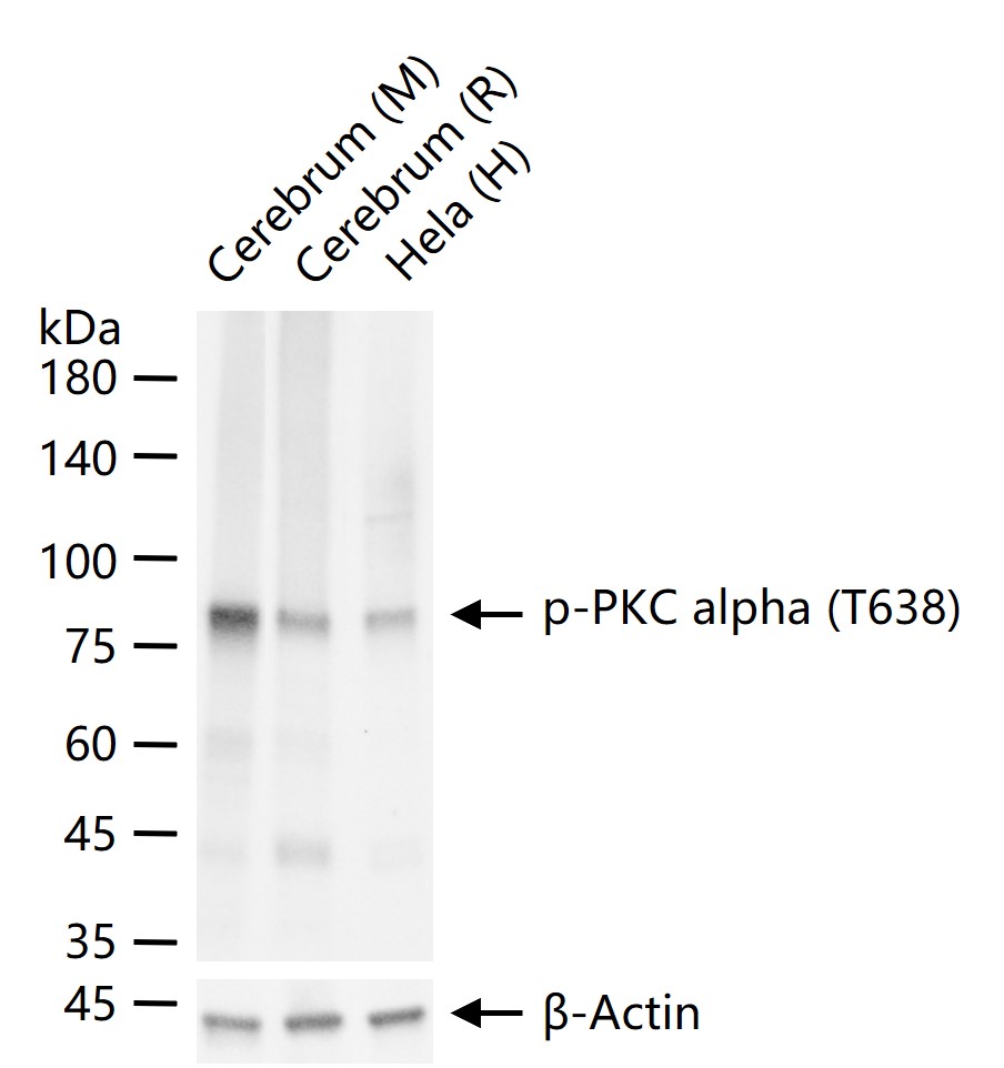 磷酸化蛋白激酶C α/β2重组兔单抗
