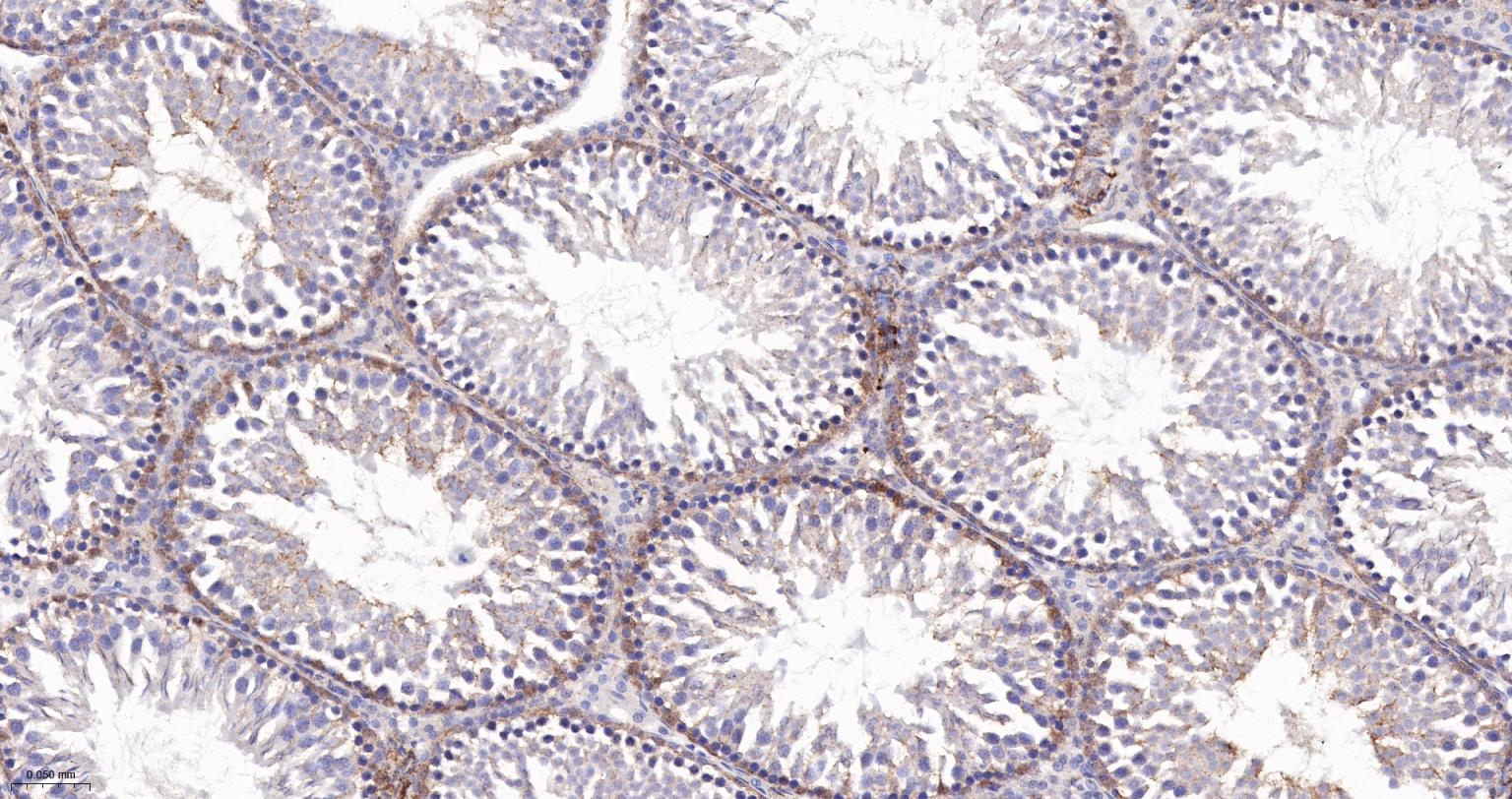 粘着斑蛋白（内参）重组兔单抗