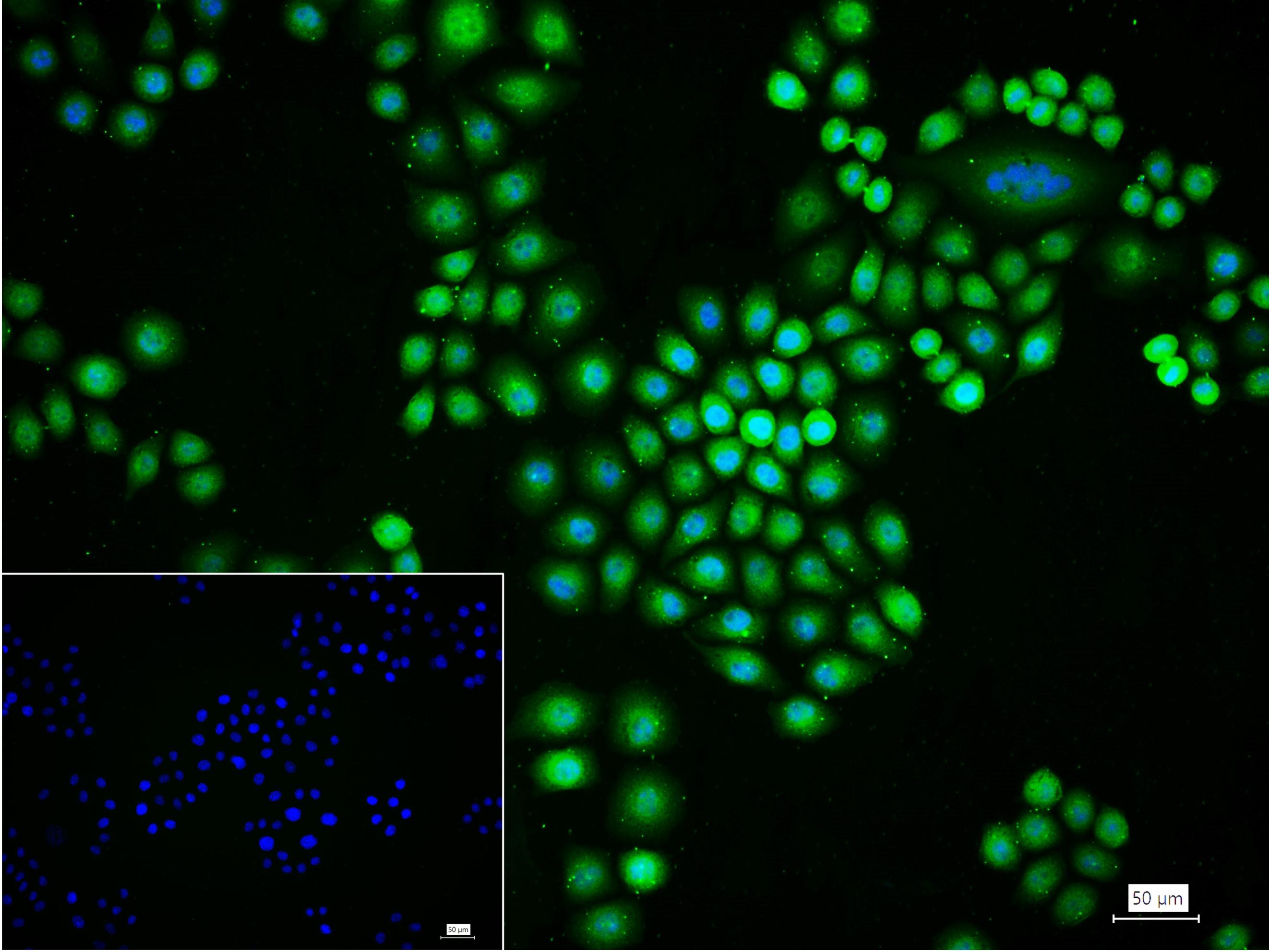 磷酸化肿瘤抑制基因PTEN重组兔单抗
